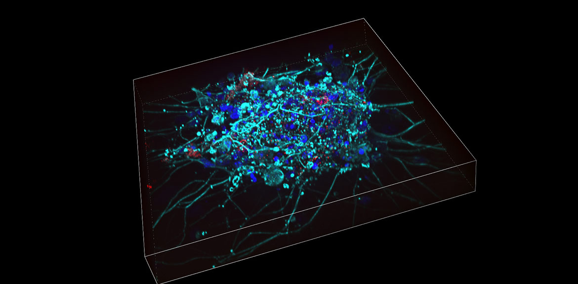 Studie av levande celler med CREST Optics spinning disk konfokal för Nikon